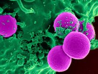 Virus Infection Dynamics